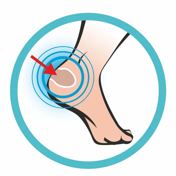 Illustration eines Fußes, bei dem ein roter Pfeil auf die Ferse zeigt, umgeben von blauen Kreisen. Foot Protector.