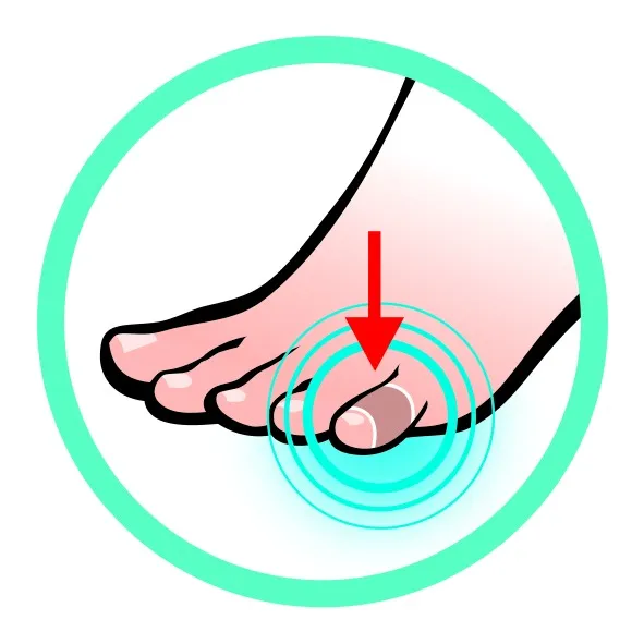 Fuß-Illustration im Kreis mit Fokus auf den Zeh, roter Pfeil zeigt Druckstelle.